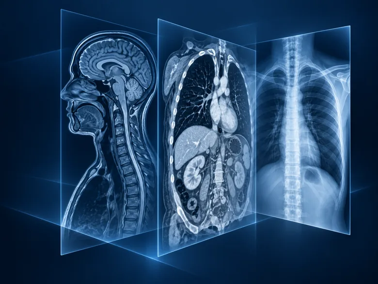 Illustration representing Oncology X-ray, CT and MR
